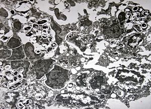 Nosema - brain, rabbit Nosema - brain, rabbit